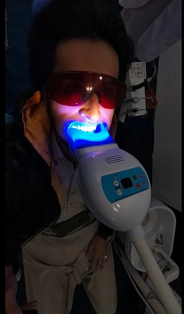 A Brilliant Smile:shahab teethWhitening Story"